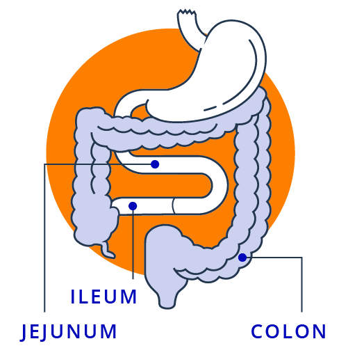 Removal of Parts of Small Intestine and Reconnection With Colon